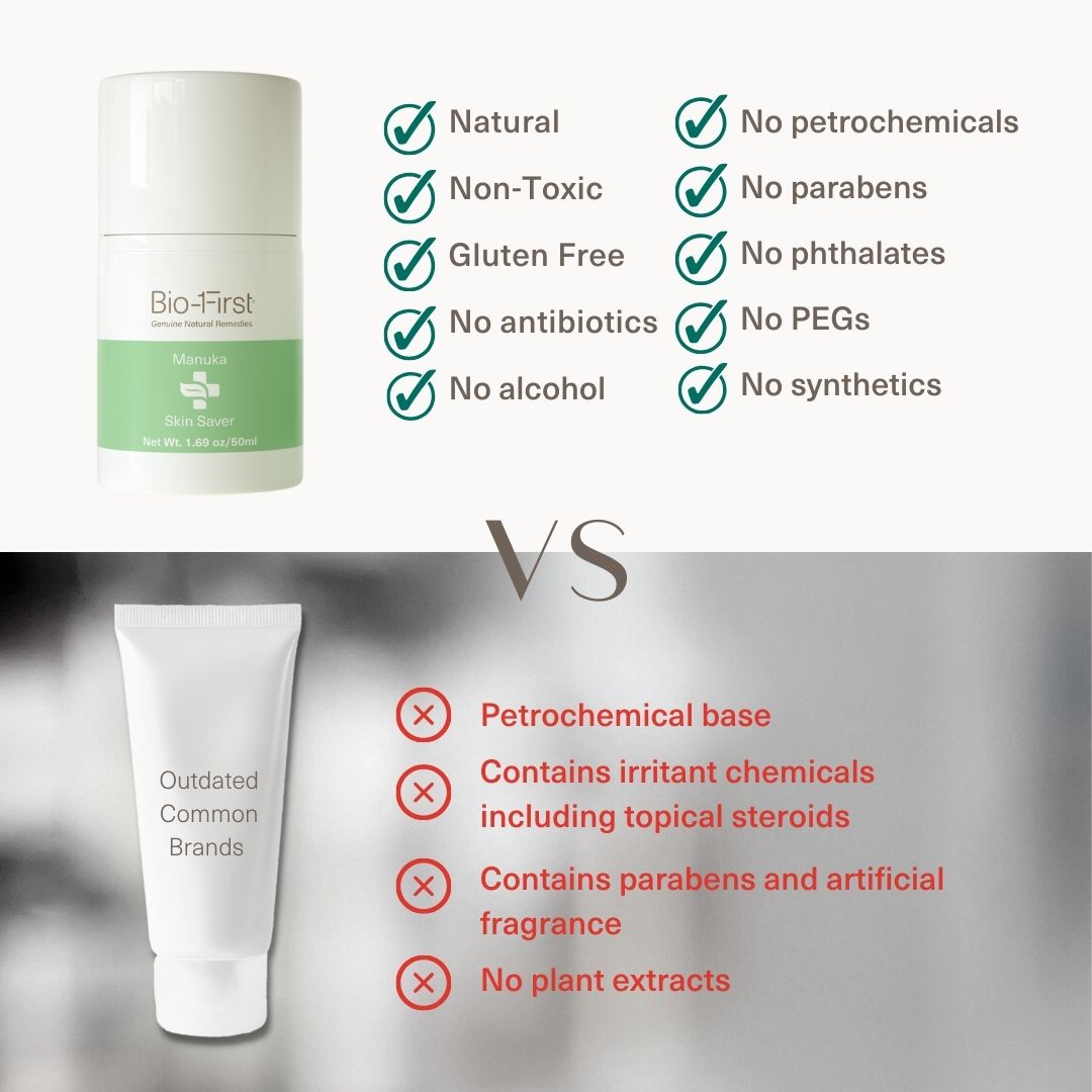 Manuka Skin Saver - Psoriasis Prone Skin