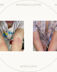 Free UltraSensitive Skin Rescue Lotion (~)