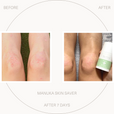 Self Healโ Salve: Your skinโs natural ally.
