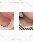 Free UltraSensitive Skin Rescue Lotion (~)