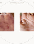 Free UltraSensitive Skin Rescue Lotion (~)