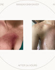 Free Manuka Skin Saver (~)