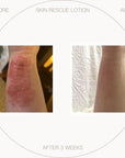 Free UltraSensitive Skin Rescue Lotion (~)