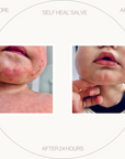 Baby & Toddler Skin Health Set
