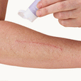 โSelf Healโ Salve: Gentle, effective skin care.
