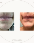 Skin Health - Face Set