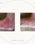 Manuka Skin Saver - Radiation & UV Damage