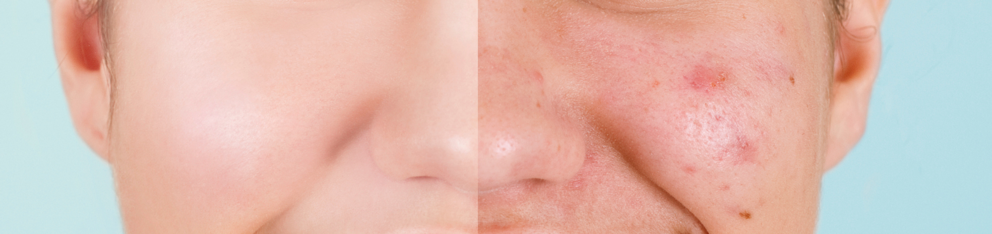 Do’s & Dont’s to Banish Blemishes with Bio-First