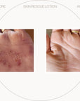 UltraSensitive Skin Rescue Lotion