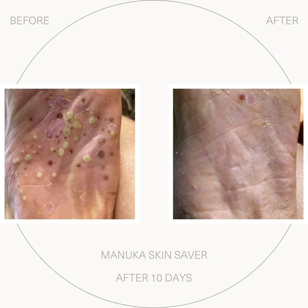 Manuka Skin Saver