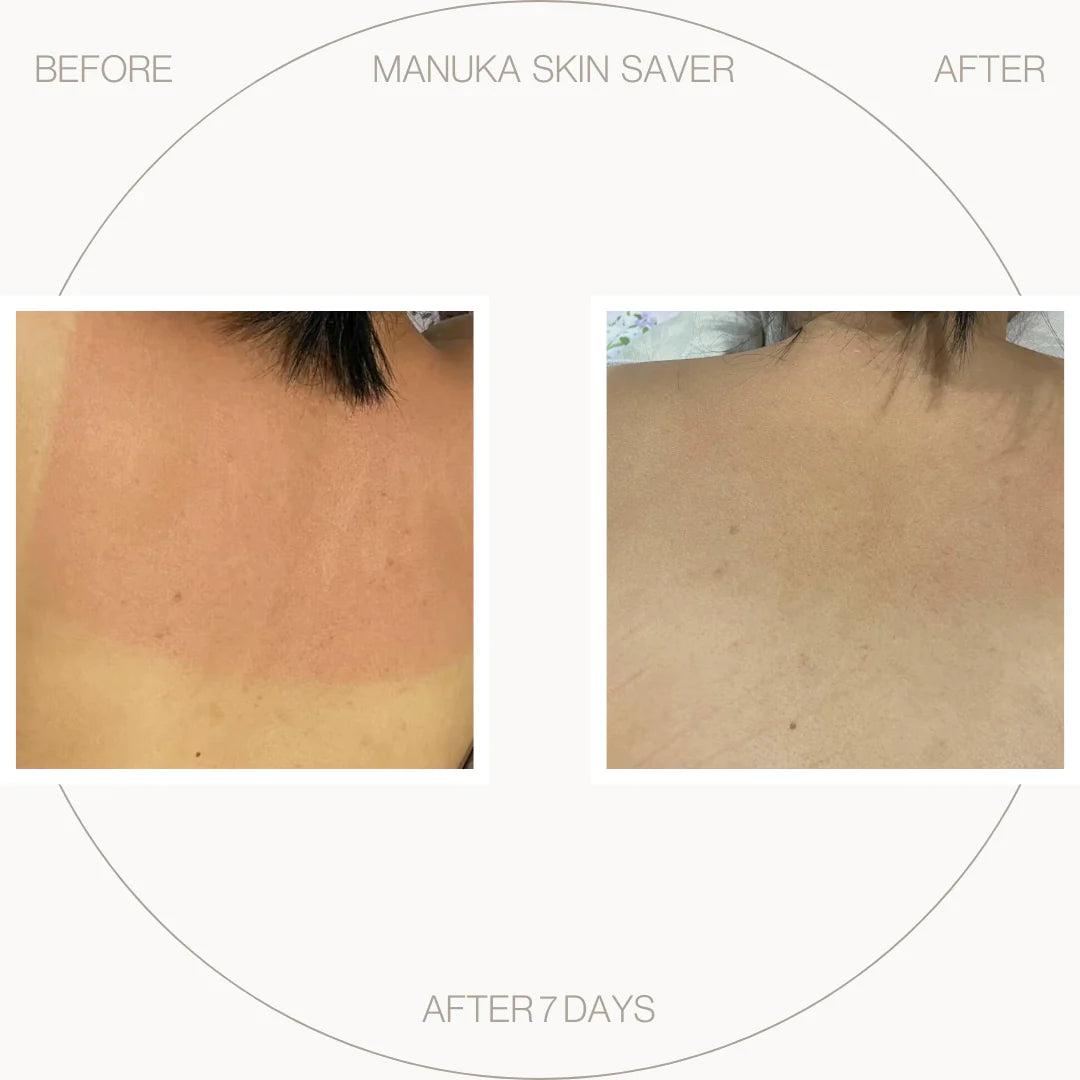 Manuka Skin Saver - Radiation & UV Damage 50 ml